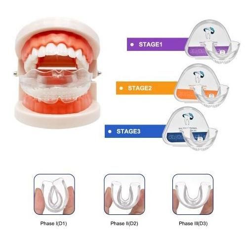 Correcteur de dents à 3 niveaux