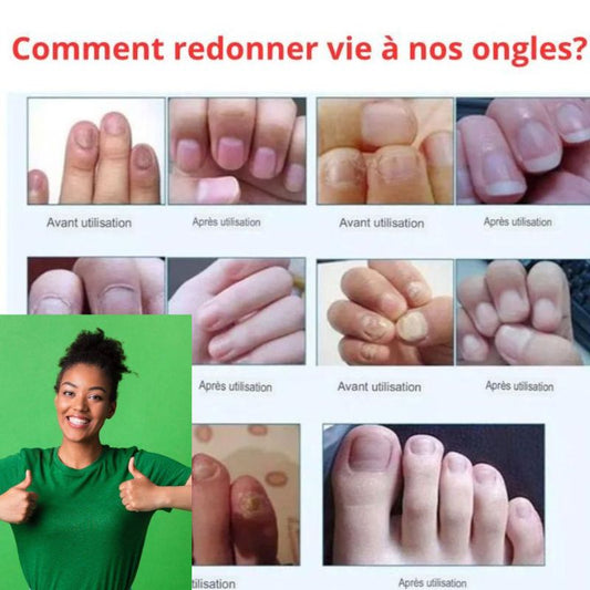 Huile Réparatrice Bio Pour Les Ongles - Pour Femme et Homme