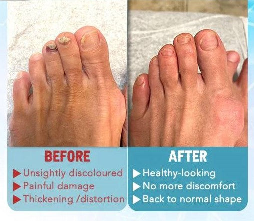 Huile Réparatrice Bio Pour Les Ongles - Pour Femme et Homme